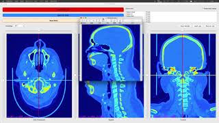 Dicom Viewer Project – 3D Processing Demo [upl. by Annasor959]