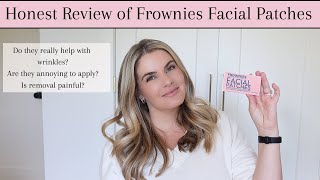 Honest Review of Frownies Facial Patches amp Everything you need to know [upl. by Nyllaf191]