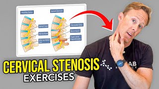 5 Exercises for Cervical Stenosis Arm Nerve Pain [upl. by Supat]