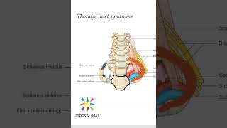 Anatomy Thorax 214 Thoracic inlet syndrome viva [upl. by Cornall]