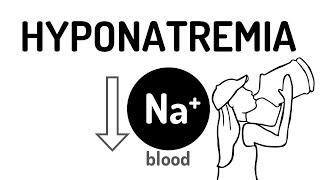 HYPONATREMIA made easy [upl. by Castra]