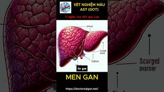 ĐỌC KẾT QUẢ XÉT NGHIỆM MÁU  MEN GAN  AST Viêm gan B rượu thuốc tây  Mengan AST GOT [upl. by Wylen]