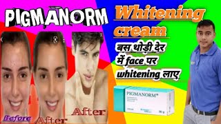 whitening cream pigmanorm इस्तेमल कैसे करे जानिए। [upl. by Rofotsirk]