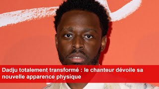 Dadju totalement transformé  le chanteur dévoile sa nouvelle apparence physique [upl. by Aihsetel239]