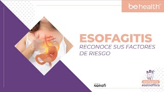 ESOFAGITIS factores de riesgo [upl. by Durstin]