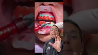 NEW Teeth Whitening InOffice Procedure Explained  In Office to Hands On Dental Training [upl. by Jecon]