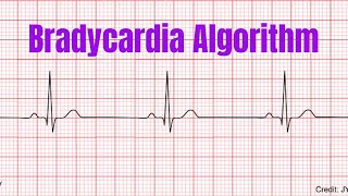 Bradycardia Algorithm [upl. by Kirkpatrick]