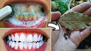 Secret that Dentists dont want you to know Remove Tartar and Teeth Whitening in just 2 minutes [upl. by Owena683]