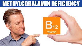 The 1st Sign of a Methylcobalamin B12 Deficiency [upl. by Zeuqcaj]