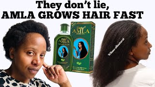 AMLA OIL Amla oil for hair growthhow to make Amla oil for hair growth Diy amla oil for hair [upl. by Leirol539]