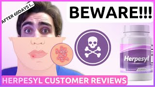 HERPESYL REVIEW  ALERT  Herpesyl Reviews  Herpesyl Customer Reviews  Herpesyl Herpes Supplement [upl. by Ttenneb747]