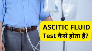 Ascitic Fluid Test in Hindi  Ascitic Fluid Analysis Procedure से क्या पता चलता हैं [upl. by Yseult]