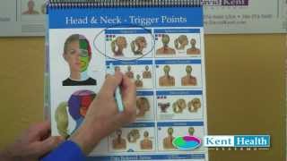 Trigger Point Chart  Color Coded Research Based Treatment Plans  Kent Flip Chart [upl. by Adnorrehs524]