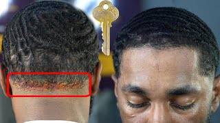 The KEY To FIXING Durag Lines And COWLICK Hairlines [upl. by Diandre]