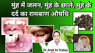 Muh ke Ander Jalan  Muh ke chale Muh ke Dard ka Rambaan upay । Mouth ulcer treatment dramitkdubey [upl. by Tedric]