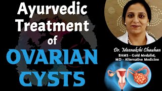 Ayurvedic Treatment of Ovarian Cysts  Dr Meenakshi Chauhan Chandigarh [upl. by Lumpkin588]