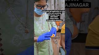 fluoride gel application treatment in Aurangabad by DrGunjan Garg SDF and fluoride varnish treatme [upl. by Nohsreg]