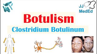 Botulism Clostridium Botulinum Pathogenesis Symptoms Diagnosis Treatment Prevention [upl. by Kenison]