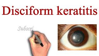 Disciform Keratitis introduction Clinical Features Signs Symptoms and Treatment [upl. by Nyrhtak]