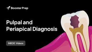 Pulpal and Periapical Diagnoses 2024 INBDE NDEB ADAT [upl. by Onavlis]