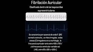 Fibrilación Auricular [upl. by Wiener761]