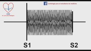 Soplo de la insuficiencia tricuspideamurmur of tricupsid regurgitation [upl. by Greenwell]