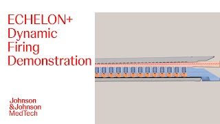 ECHELON Dynamic Firing Video  JampJ MedTech [upl. by Kaia]
