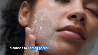 Clear Acne and Prevent New Breakouts │ CeraVe Skincare [upl. by Yreneh481]