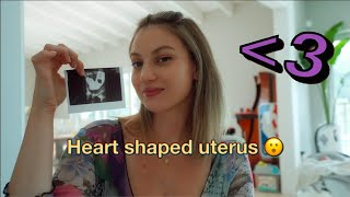 Do you have a Heart Shaped Uterus Bicornuate uterus [upl. by Ainud331]