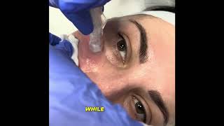 WHY Wednesday  Microneedling with AnteAGE MD Growth Factors and Cytokines [upl. by Gere990]