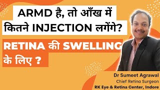 RETINA SWELLING के लिए कितने INJECTIONS लगते हैं  सीधा और सटीक jawaab रेटिना स्पेशलिस्ट से । [upl. by Ala]