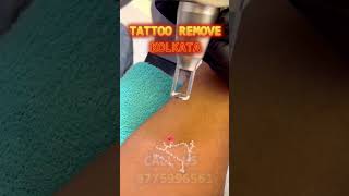 LESAR TREATMENT TATTOO REMOVE  RAINBOW BEAUTY AND TATTOO rainbowasmr haircut hairstyle barber [upl. by Rockefeller]