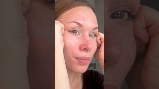 Puffy eyes dark circles under eye bags massage technique [upl. by Yauqram541]