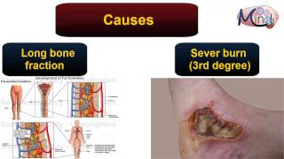 Pathology 3D  Circulation  Embolism [upl. by Hcaz]