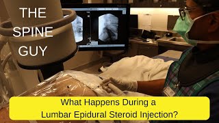 What Happens During a Lumbar Epidural Steroid Injection [upl. by Danforth602]