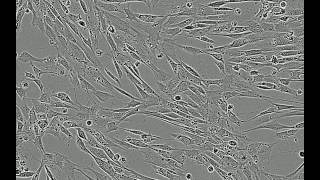 Adipogenic Differentiation of Human Mesenchymal Stem Cells in MSCgo Differentiation Media [upl. by Aslehc]