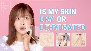 You Have Dry Skin amp ACNE Best Skincare for Dry vs Dehydrated Skin l You Need to See This [upl. by Graniah]