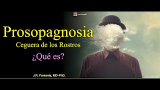 Ceguera de los Rostros Prosopagnosia ¿Qué es [upl. by Ardnuasal814]