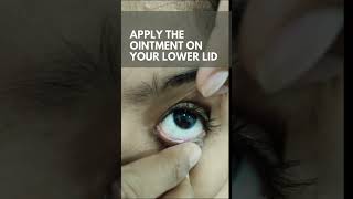 HOW TO APPLY EYE OINTMENT PROPERLY  NEW VISION EYE HOSPITAL MUNDAKAYAMPOONJAR [upl. by Durstin]