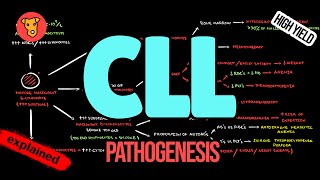 CHRONIC LYMPHOCYTIC LEUKEMIA Pathogenesis CLL Criteria Diagnosis Treatment [upl. by Vinn]