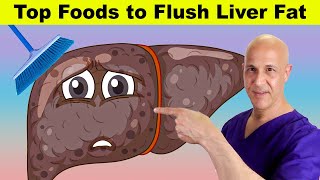 Top Foods to Flush Liver Fat  Dr Mandell [upl. by Christoffer718]