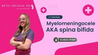 Case study 93 Myelomeningocele AKA spina bifida explained by Dr Grunch neurosurgeon spinabifida [upl. by Arica]