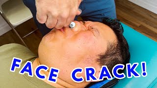 TMJ RELIEF AFTER ONE ADJUSTMENT  A FACE CRACK [upl. by Ecissej523]