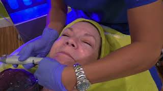 Hydrafacial Infusion with Peptides [upl. by Neelie]