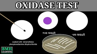 Oxidase Test [upl. by Lilyan]