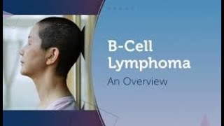 Bcell Lymphoma Symptoms and Causes  Diagnosis  Treatment  Prevention [upl. by Ullund]