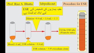 ESR VS CRP by Prof Riaz A Bhutta labpedianet Urdu Hindi [upl. by Haizek]