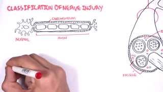 Neurology  Nerve Damage and Regeneration [upl. by Slen]