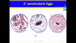 Enterobius vermicularis Nematodes [upl. by Sikata]