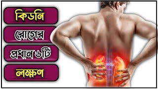 কিডনি রোগের প্রধান ছয়টি লক্ষণ  Symptoms of of kidney disease  Renal disease [upl. by Bradlee268]